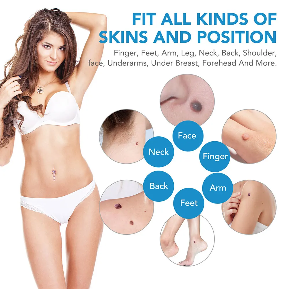 Kit de ferramentas para remoçã - Acne Light Therapy Pen avaliação e preço
