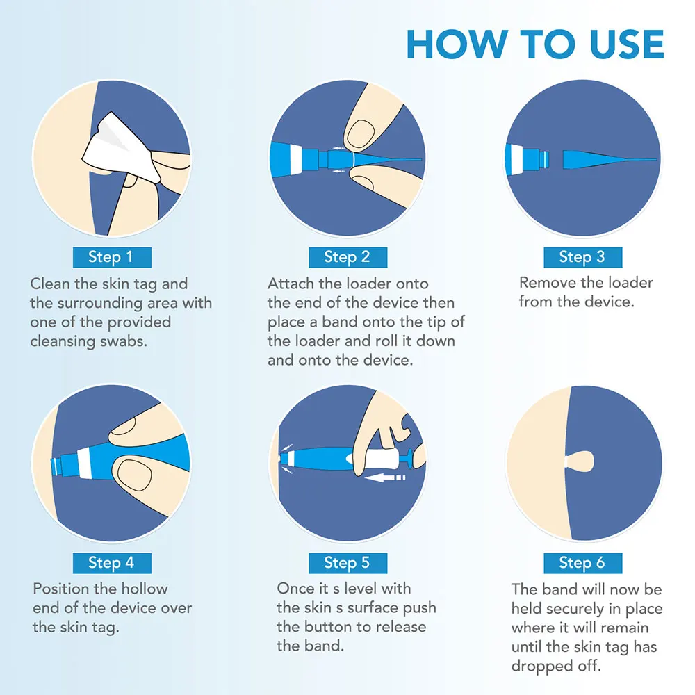 Kit de ferramentas para remoçã - Acne Light Therapy Pen avaliação e preço