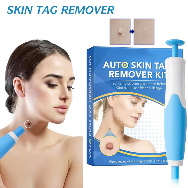 Kit 2 em 1 para Remoção de Ver - Acne Light Therapy Pen avaliação e preço