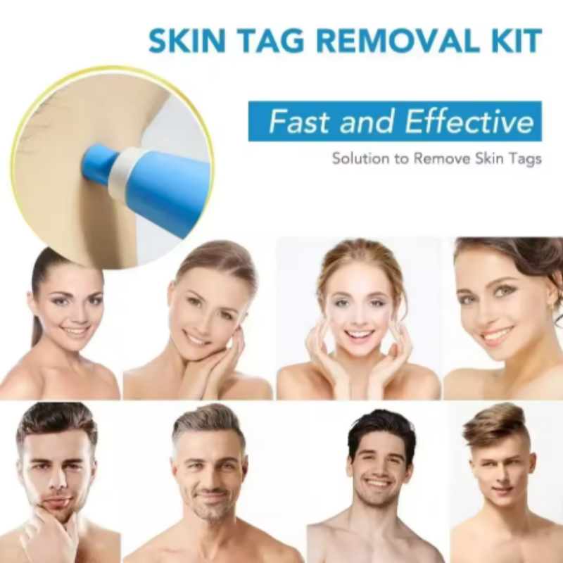 Kit Removedor de Verrugas para - Acne Light Therapy Pen avaliação e preço